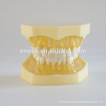 China Medical Anatomical Model Transparent Soft Gingiva Dental Jaw Model 13013